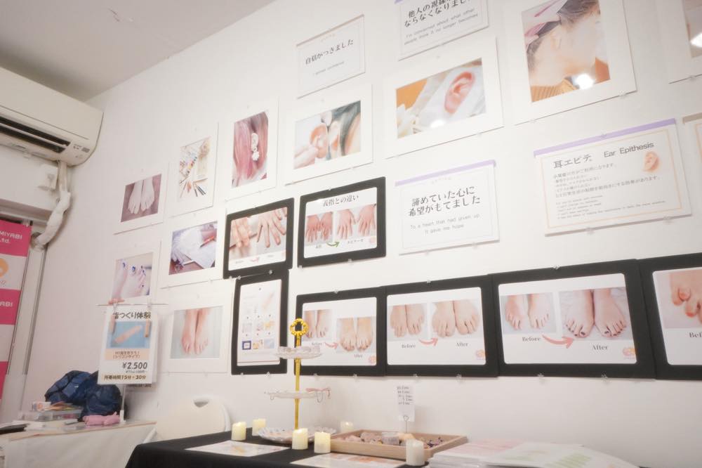 Epitheses exhibition held in November 2024; before and after photos line the walls